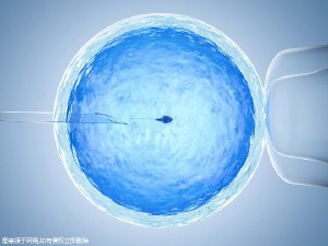 医疗设备